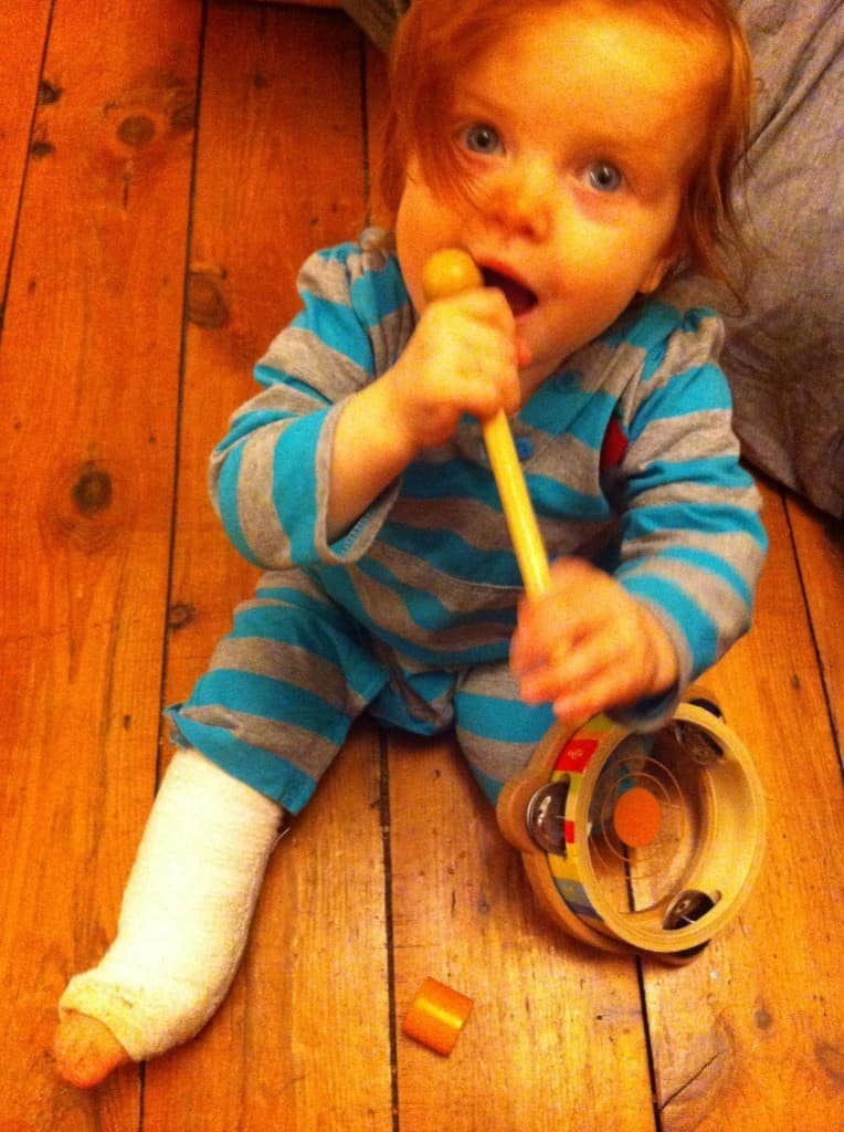 When Our Toddler Broke Her Leg